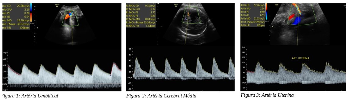 Dopplerfluxometria Obst Trica Origem Med